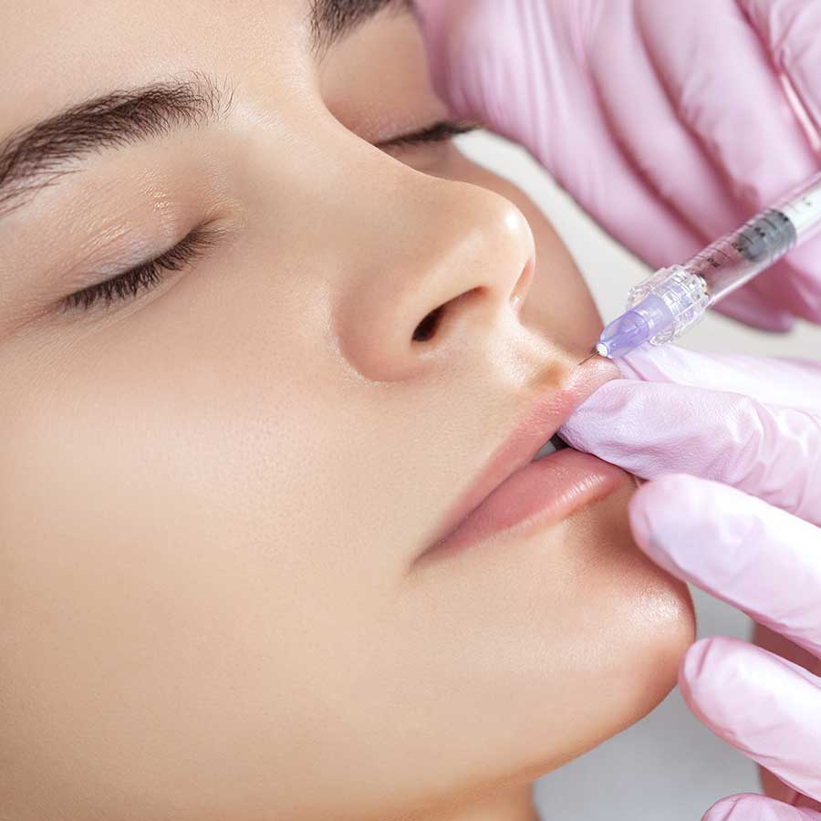 dermal-fillers