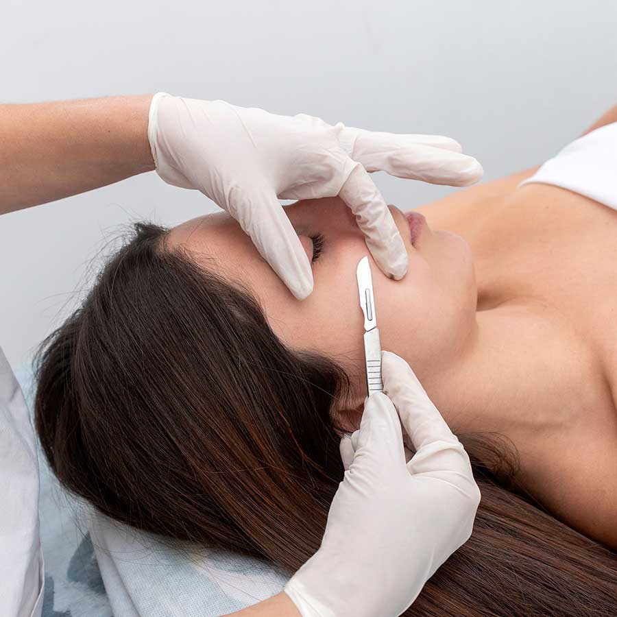 dermaplaning